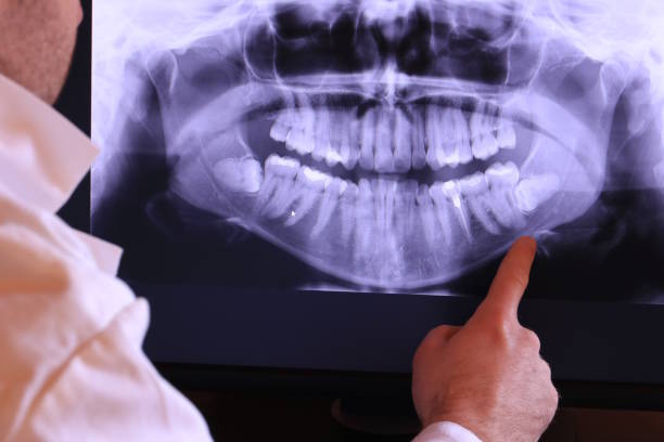 Best Emergency Tooth Extraction in Windsor, MO